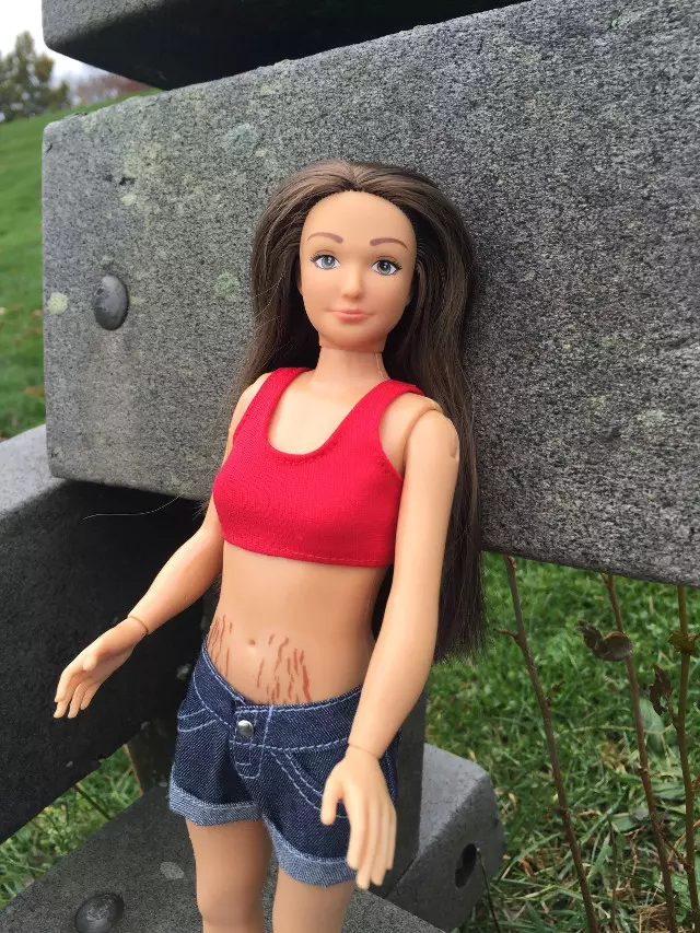 Lammily Doll, la bambola realista con le smagliature