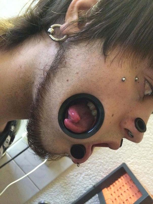 Ragazzo con dei buchi sulle guance