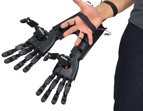 La doppia mano bionica della Youbionic