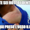 tE SEI ROTTO I DENTI HAI PRESO L'OSSO u.u