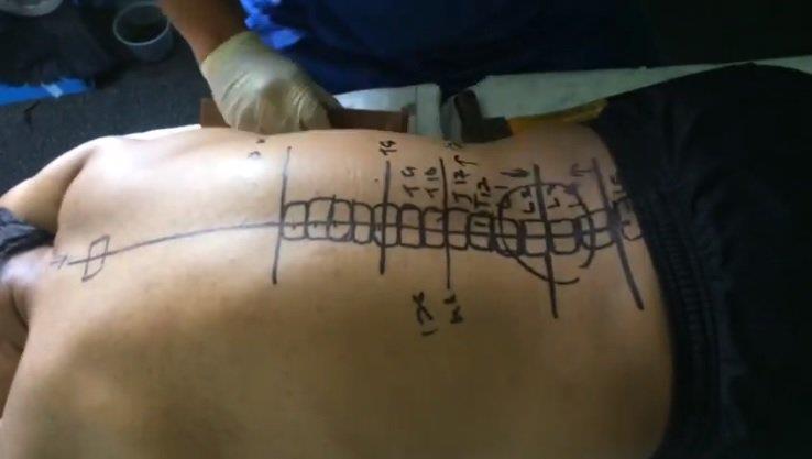 Il diagramma disegnato dal chiropratico
