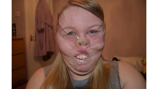 Ragazza con faccia avvolta da nastro adesivo
