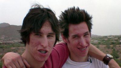 I 2 gemelli prima degli interventi