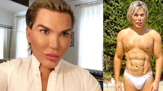 Il Ken umano si è fatto rimuovere quattro costole Rodrigo Alves è il Ken umano