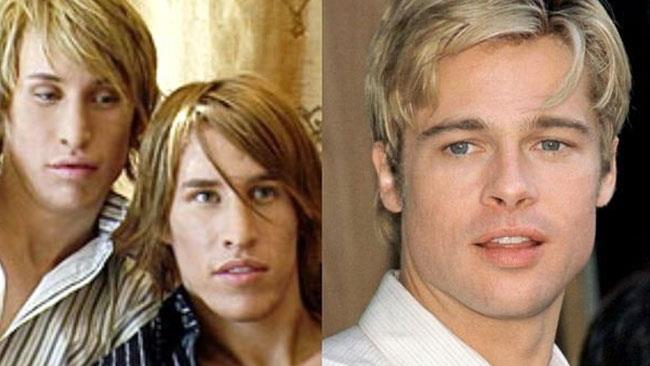 I gemelli che hanno speso 20mila dollari per somigliare a Brad Pitt I 2 gemelli dopo l'operazione e Brad Pitt