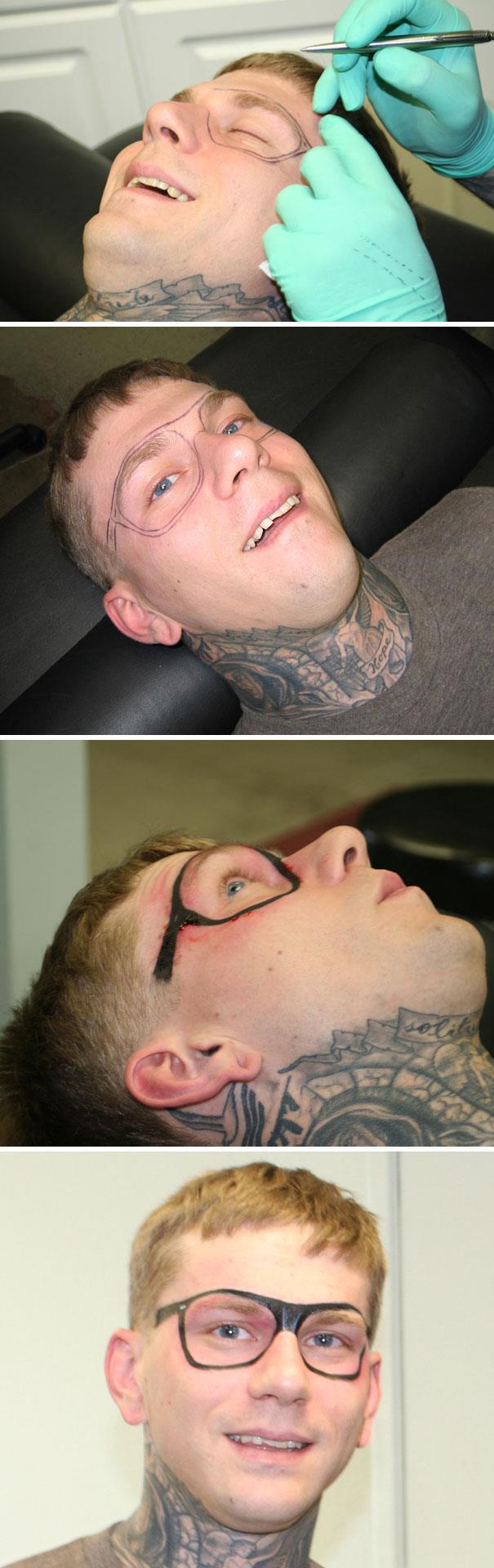 Un ragazzo che si è tatuato degli occhiali - I peggiori tatuaggi mai realizzati