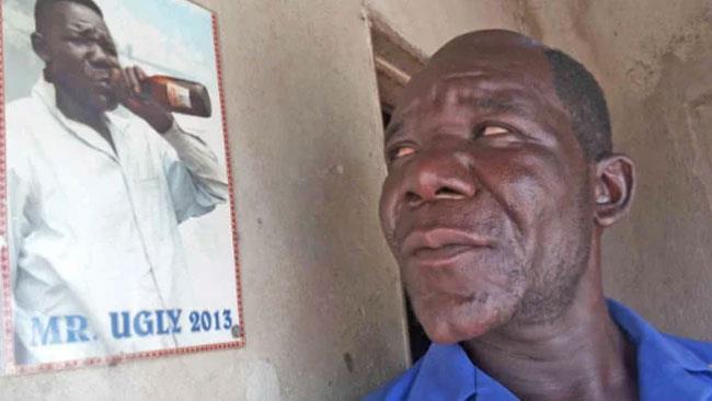 William Masvinu è onorato di aver ricevuto il titolo di uomo più brutto dello Zimbabwe William Masvinu mostra il titolo ricevuto