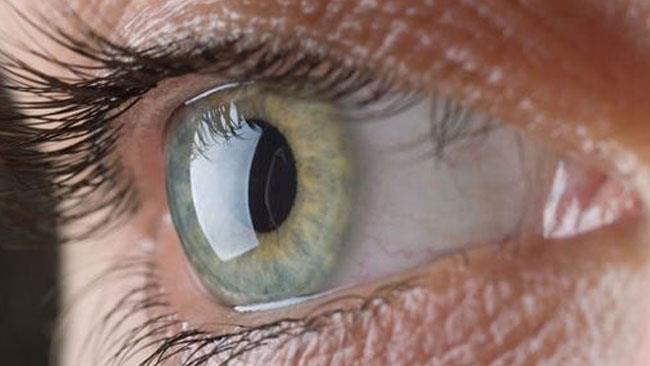 Medici britannici usano cellule staminali per curare la degenerazione maculare senile Il rimedio alla degenerazione maculare è un trattamento condotto tramite staminali