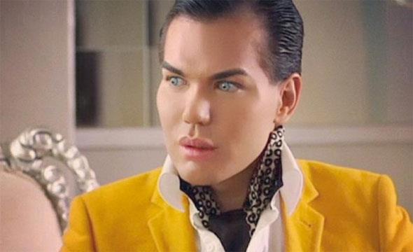 La chirurgia plastica l'ha trasformato in Ken di Barbie