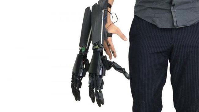 Youbionic crea la protesi fatta di due mani robotiche L'arto bionico di Youbionic
