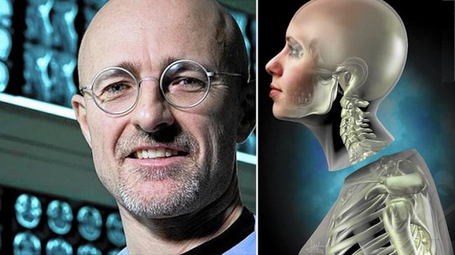 Il primo trapianto di testa umana al mondo è realtà! Il neurochirurgo italiano Sergio Canavero