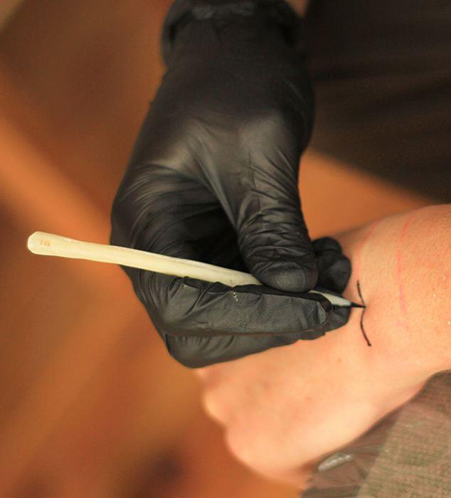 La procedura per ricreare il tatuaggio di Otzi