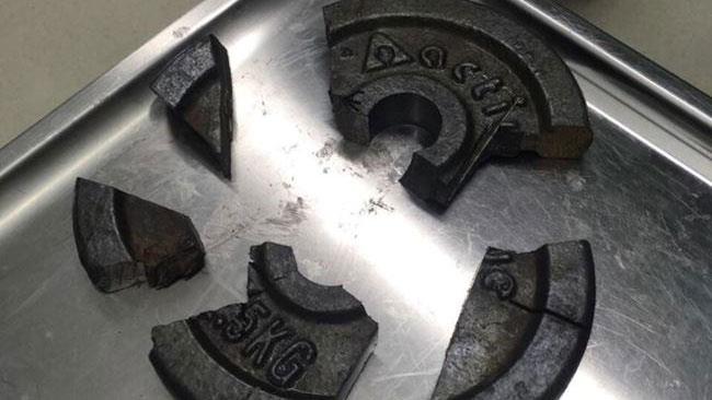 Pompieri soccorrono un uomo col pene incastrato in un peso discoidale Il peso dove era incastrato il pene