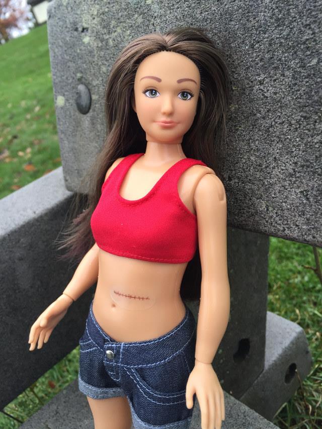 Lammily Doll, la bambola con le cicatrici