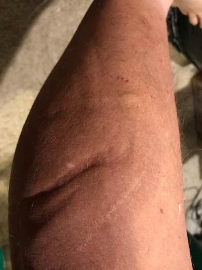 Le cicatrici che ha John sul corpo