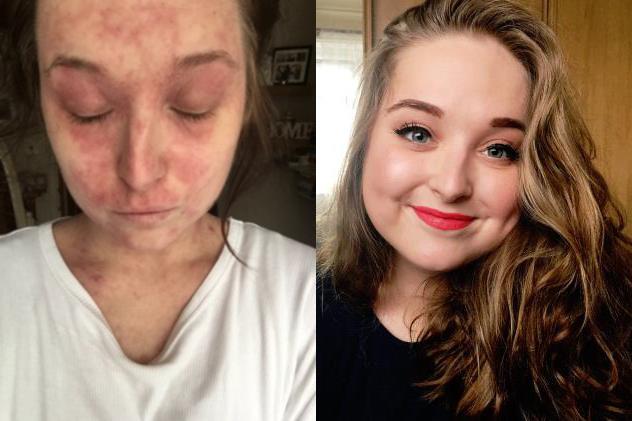 Prima e dopo di Megan Primo piano della donna