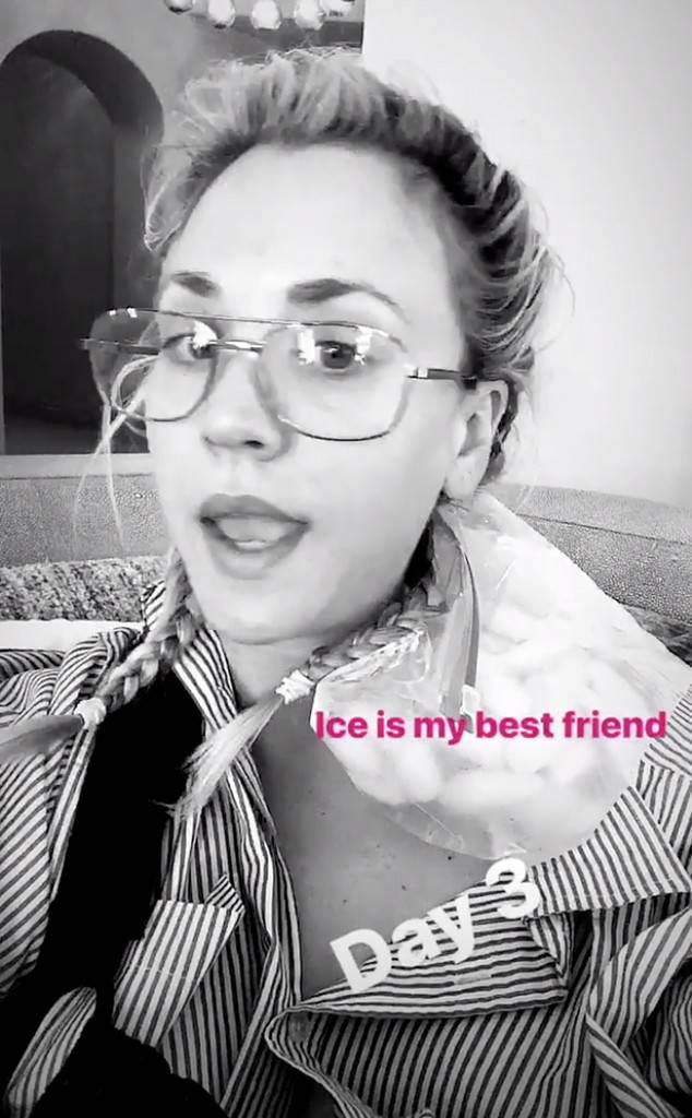 Kaley Cuoco al terzo giorno di convalescenza Kaley Cuoco