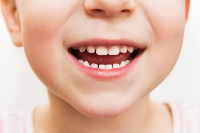 Denti da latte e autismo: una ricerca svela le connessioni Denti
