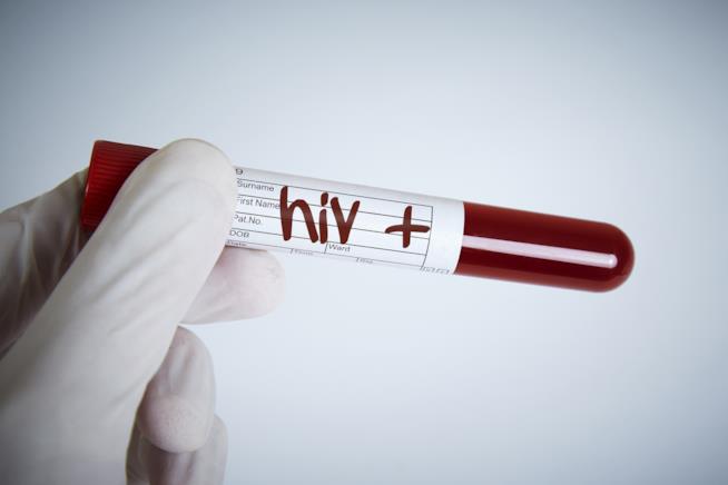 hiv hiv
