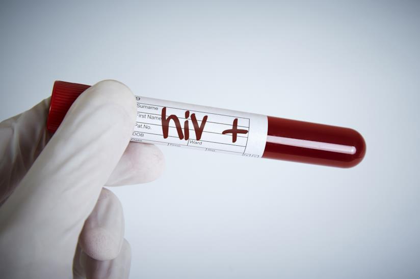 hiv hiv