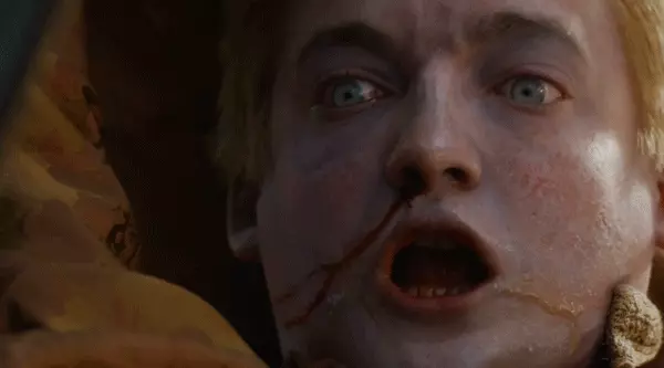 Jack Gleeson ne Il Trono di Spade La morte di Re Joffrey