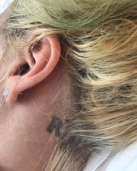 Lady Gaga: Tatuaggio Lady Gaga in ospedale mostra il tatuaggio RIO