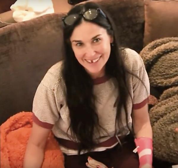 Demi Moore e lo stress, l'attrice ha perso due denti Demi Moore senza i due incisivi frontali
