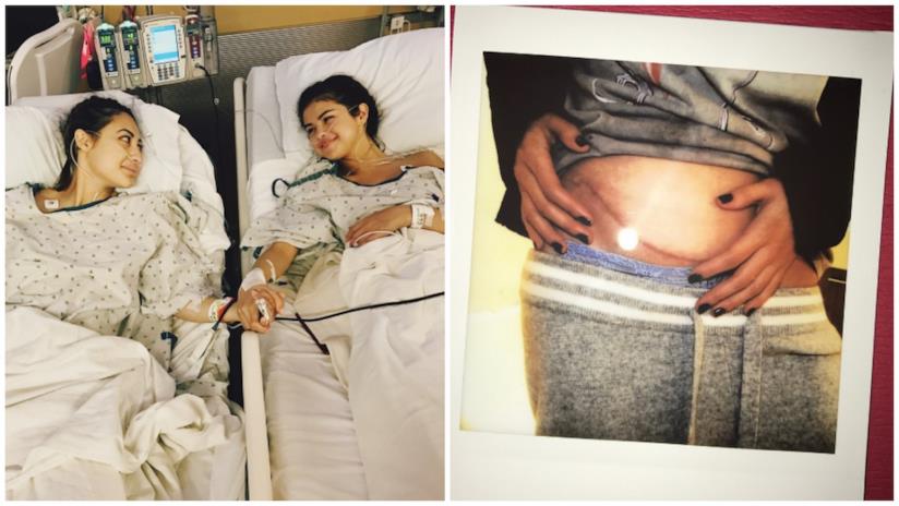 Selena Gomez racconta il suo trapianto di rene Selena Gomez dopo il trapianto di rene