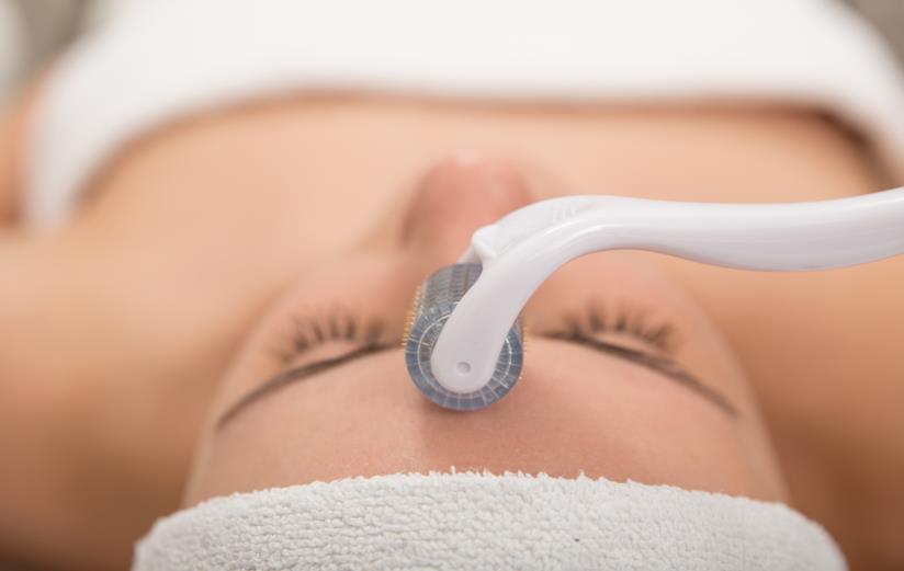 Tutti i segreti del needling Il needling