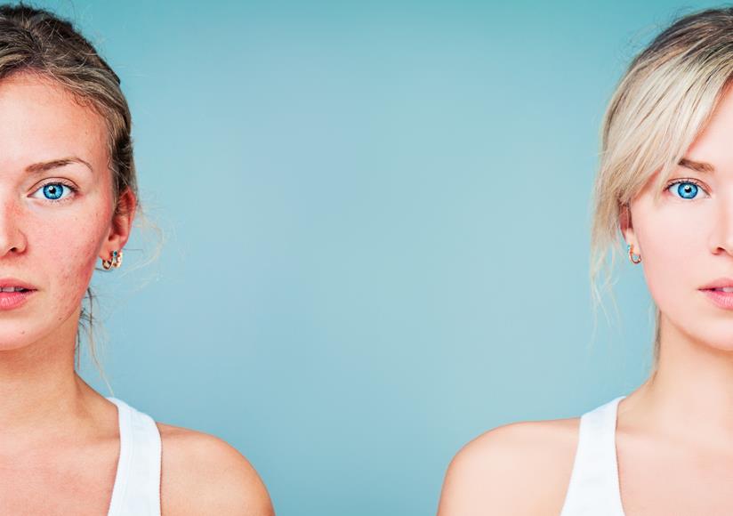 Ormoni femminili Primo piano di due ragazze