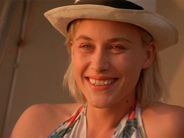 Patricia Arquette, quando un difetto diventa una firma