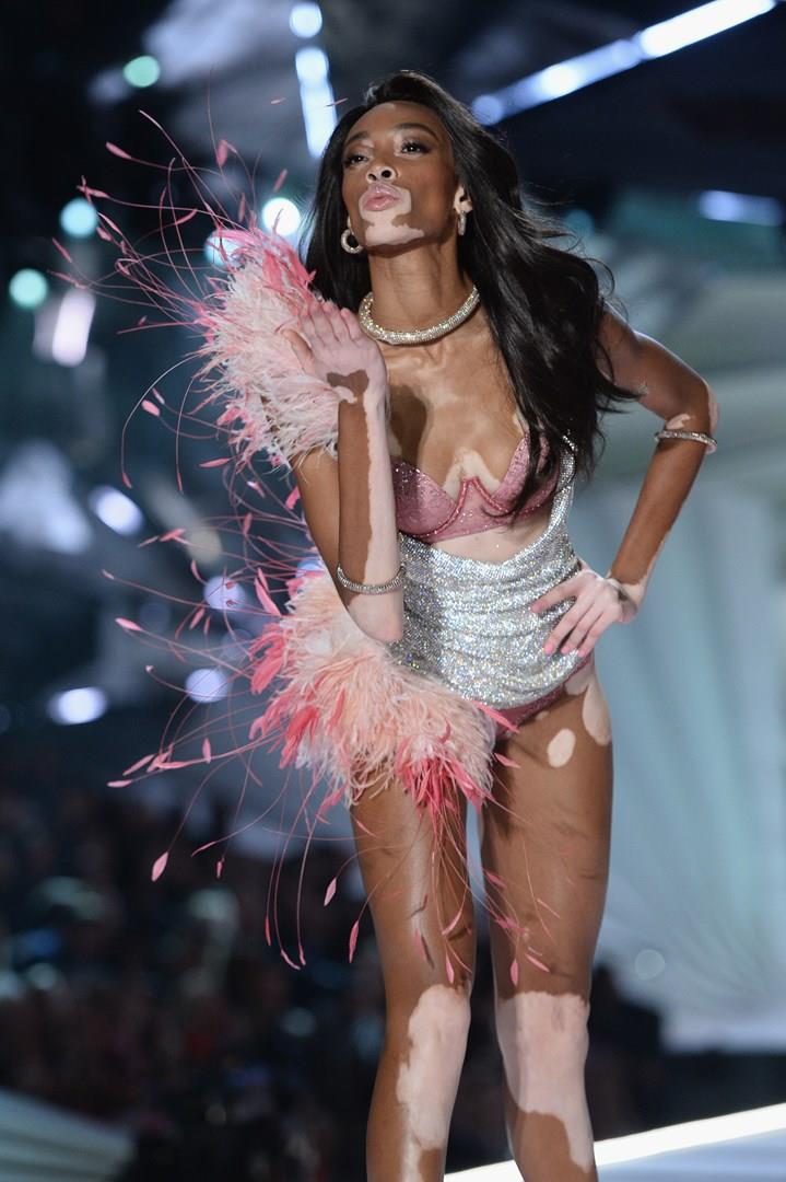 Victoria's Secret Fashion Show - Winnie Harlow Winnie Harlow sfila per il Victoria's Secret Fashion Show
