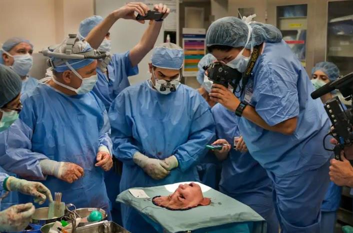 Trapianto di volto di Katie Stubblefield Il trapianto di volto al Cleveland Clinic