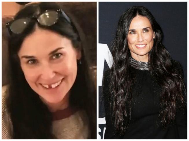 Demi Moore ha perso due denti per lo stress Demi Moore senza denti e dopo le protesi