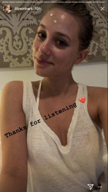 Un selfie di Lili reinhart Lili Reinhart si scatta una foto dopo essersi applicata crema sulla fronte