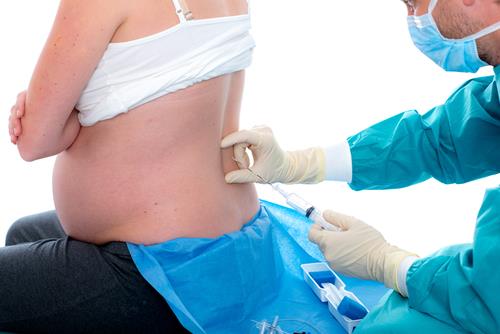 Fare l'epidurale Fare l'epidurale