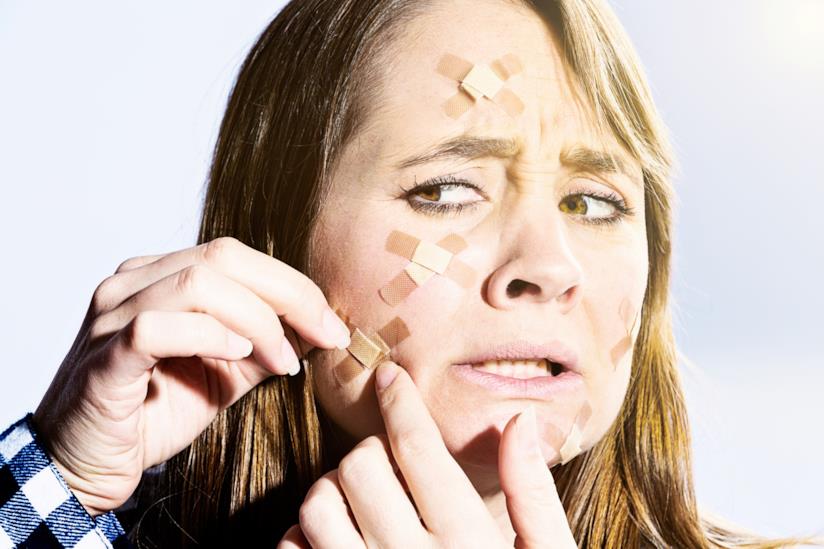 Come difendersi dalle punture degli insetti Donna incerottata in viso