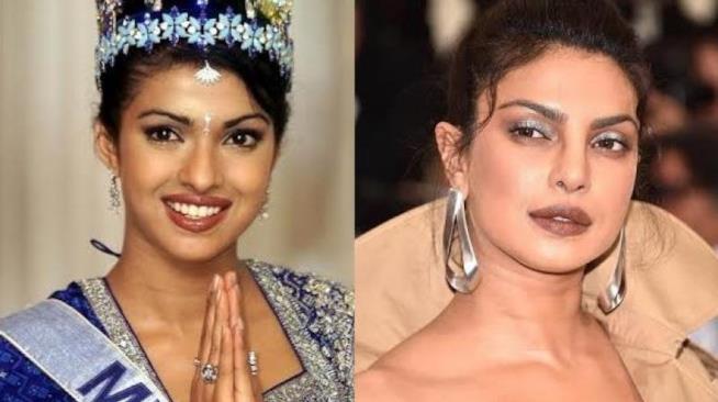 Priyanka Chopra rovinata dalla chirurgia Priyanka Chopra prima e dopo la chirurgia