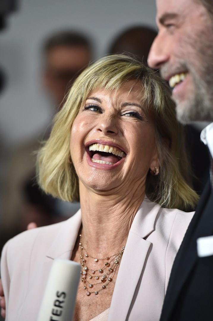 John Travolta e Olivia Newton-John Gli attori John Travolta e Olivia Newton-John