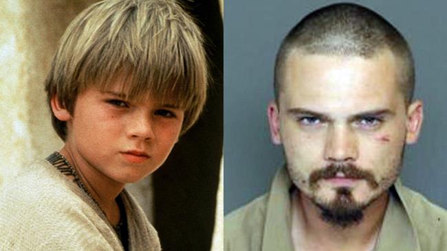 Star Wars, l'attore che da bambino prestò il volto ad Anakin in clinica psichiatrica Anakin Skywalker - Star Wars, l'attore Jake Lloyd