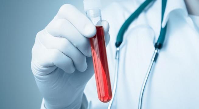 Sangue dei giovani come medicina per malattie legate all'età Provetta di sangue
