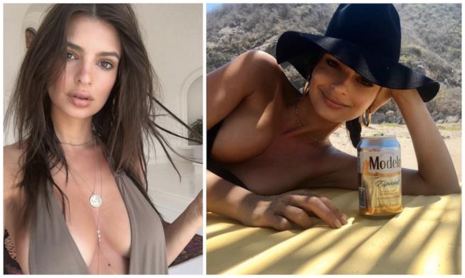 Emily Ratajkowski e la scottatura solare che diventa accessorio sexy La foto con scottatura solare di Emily Ratajkowski