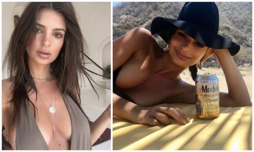 Emily Ratajkowski e la scottatura solare che diventa accessorio sexy La foto con scottatura solare di Emily Ratajkowski