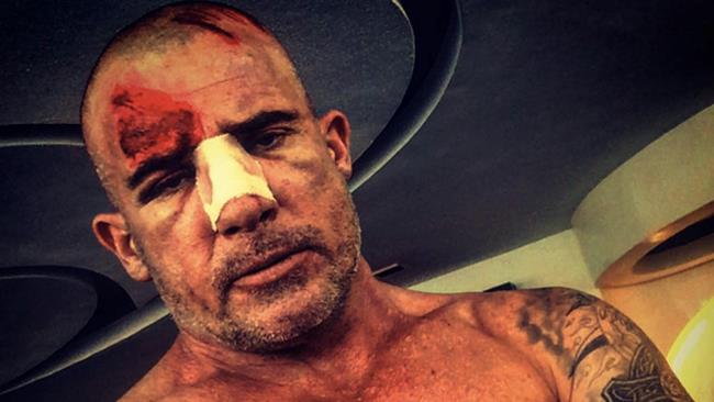 Dominic Purcell: incidente sul set del nuovo Prison Break Dominic Purcell