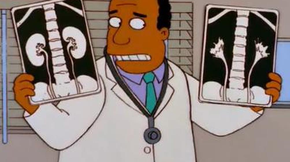 Homer_Simpson_in _problemi_di_reni._Reni_scoppiati
