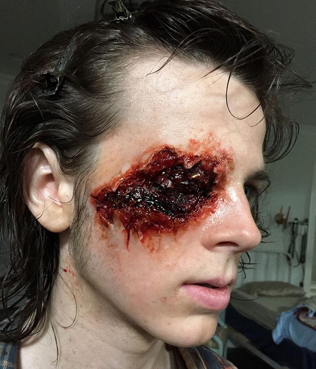 Chandeler Riggs mostra la ferita all'occhio di Carl Chandler Riggs (Carl) in una foto di backstage della stagione 6 di The Walking Dead