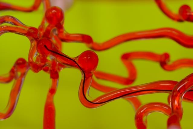 MIT mette a punto dei 'vermi robot' contro gli ictus cerebrali Il "verme robot" sviluppato dal MIT mentre si muove attraverso un modello di vasi sanguigni