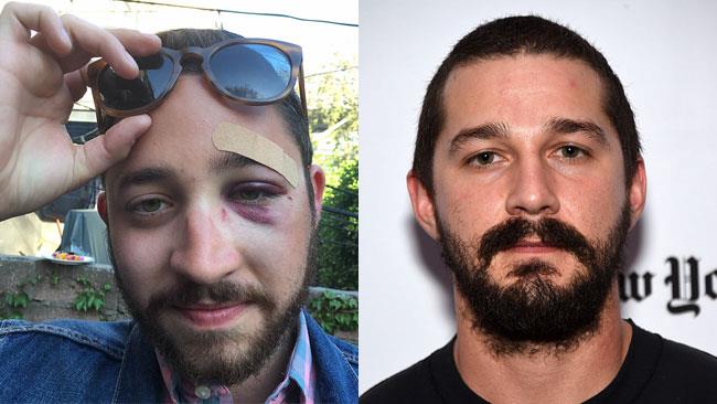 Aggredito perché somiglia a Shia LaBeouf Mario Licato e Shia LaBeouf