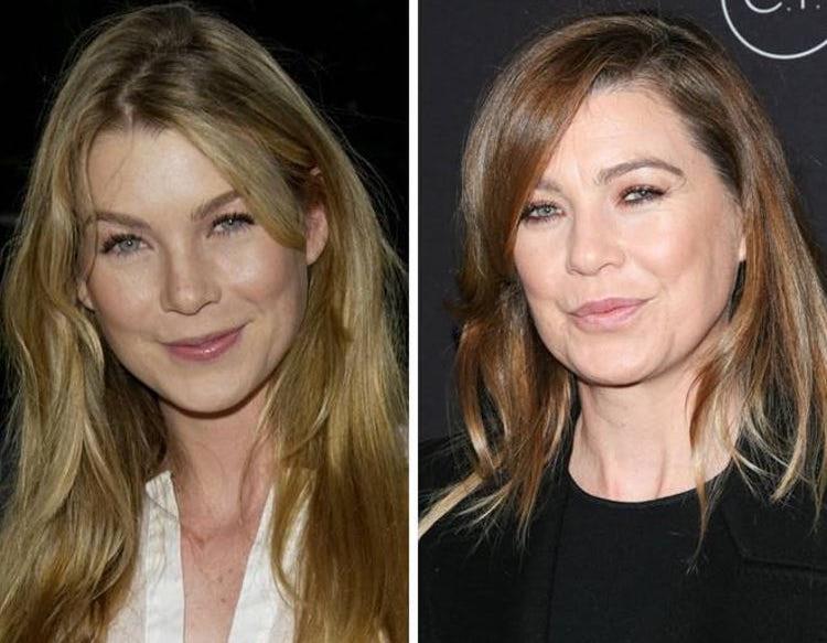 L'attrice prima e dopo La famosa attrice prima e dopo
